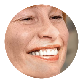 dental-implant-single-tooth-replacement | Taylor Dental Implants and Aesthetics dental-implant-single-tooth-replacement