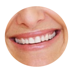smile-dental-aesthetic-treatments-gold-coast